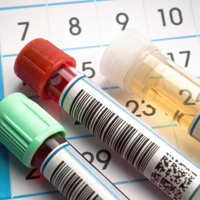 Proben mit Blut etc.